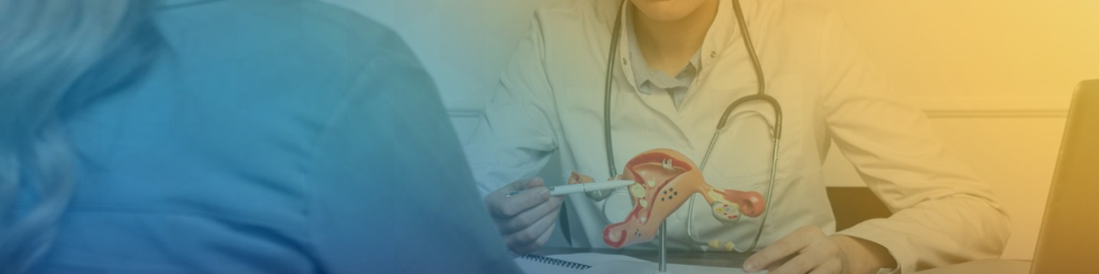 Fibroids Treatment
